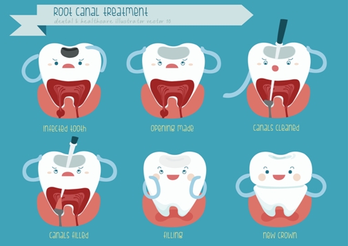 The Danger Of Ignoring Root Canal Treatment Springdale Dental Centre